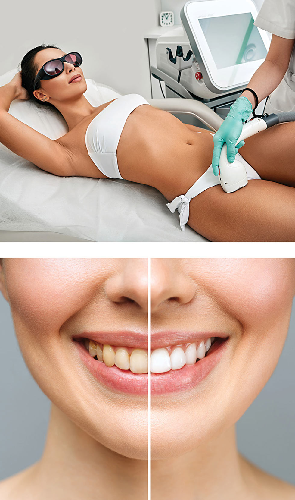 woman undergoing a hair removal process; teeth whitening before and after comparison